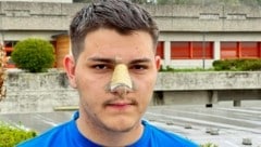 Das Opfer der Prügelattacke wurde übel zugerichtet. Der 17-Jährige lag im Spital in Oberwart. (Bild: Christian Schulter)