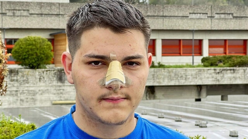 Das Opfer der Prügelattacke wurde übel zugerichtet. Der 17-Jährige lag im Spital in Oberwart. (Bild: Christian Schulter)