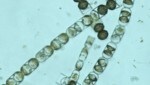Mikroskopische Aufnahme der unter dem Meereis wachsenden Algenart Melosira arctica, die sich besonders stark mit Mikroplastik anreichert (Bild: Alfred-Wegener-Institut/Alexandra Kraberg)