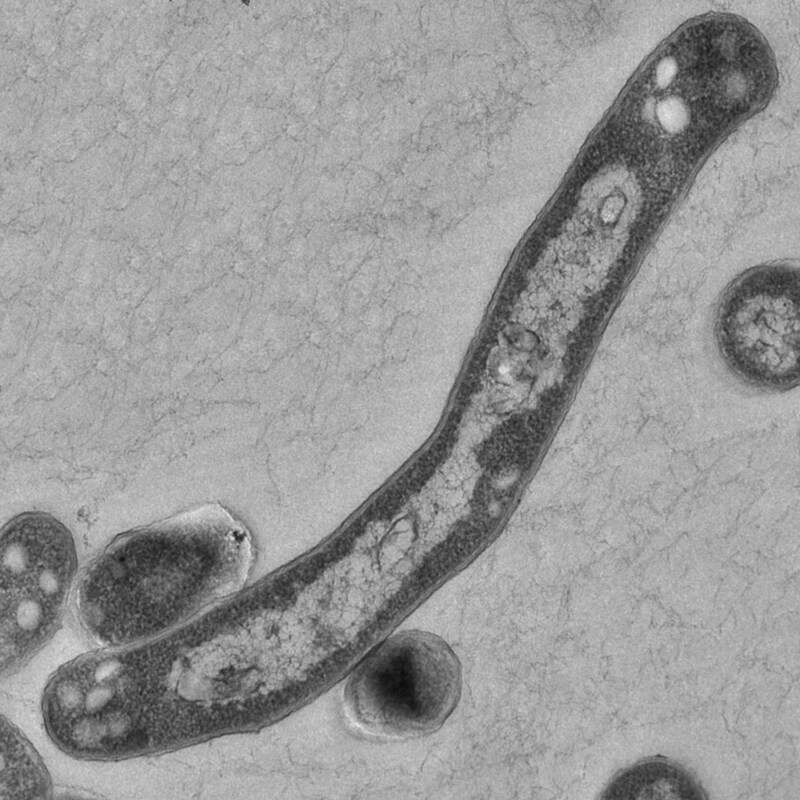 Ein Tuberkulose-Erreger unter dem Elektronenmikroskop (Bild: APA/RKI/Gudrun Holland)