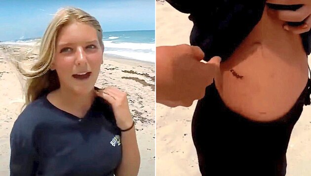 Die Schülerin schilderte im TV die Attacke und zeigt eine Narbe. (Bild: WPTV)