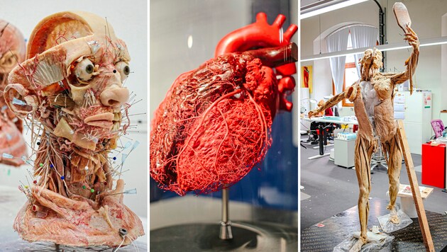 Beeindruckende anatomische Projekte: Demnächst kommt die Ausstellung nach Innsbruck. (Bild: Hubert Berger)