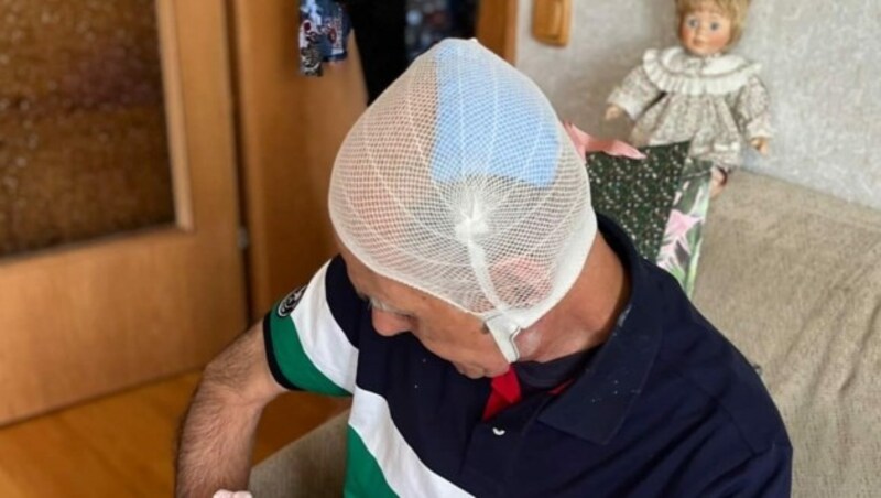Die drei Kopfwunden des 69-Jährigen wurden im KUK Linz genäht. (Bild: ZVG)