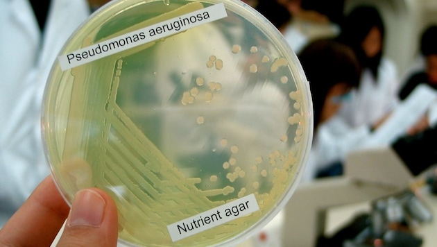 Der Erreger Pseudomonas aeruginosa in einer Petrischale (Bild: wikipedia.org/Denise Chan, Krone KREATIV)