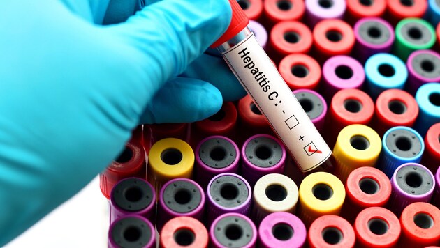 Der Kärntner Liebhaber steckte seine Partnerin mit einem gefährlichen Virus an: Seine Aussagen dazu sind beklemmend. (Bild: jarun011 - stock.adobe.com)