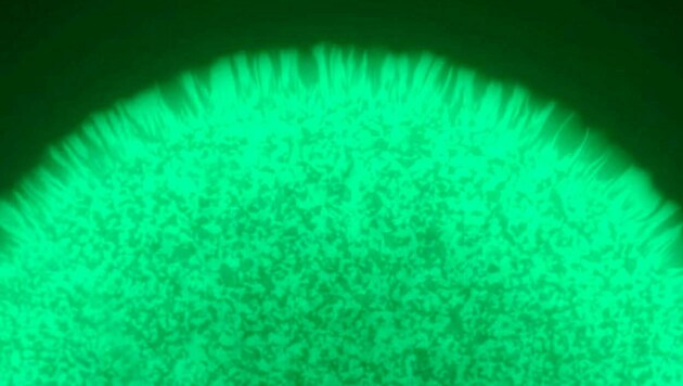 Mikroskopische Aufnahme von manipulierten Bakterien, die grün leuchten, nachdem sie Tumor-DNA entdeckt haben (Bild: University of Adelaide/Susan Woods)