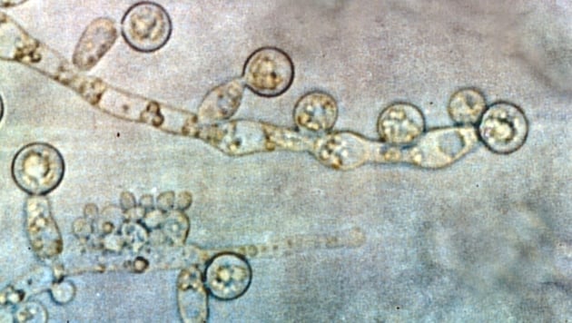 Eine Infektion mit Candida albicans kann verheerende Folgen haben - dazu trägt auch das Immunsystem selbst bei. (Bild: Dr Graham Beards, CC BY-SA 3.0, via Wikimedia Commons)