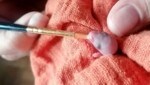 Um dieses Mäuschen kümmerte man sich liebevoll, aber leider vergebens. (Bild: Tierheim Krems)