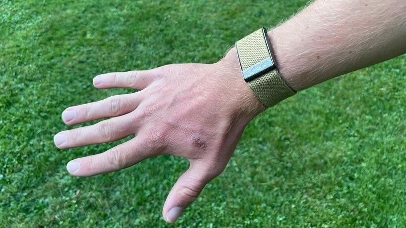 Das Whoop-Armband von Christoph Hochenwarter.
