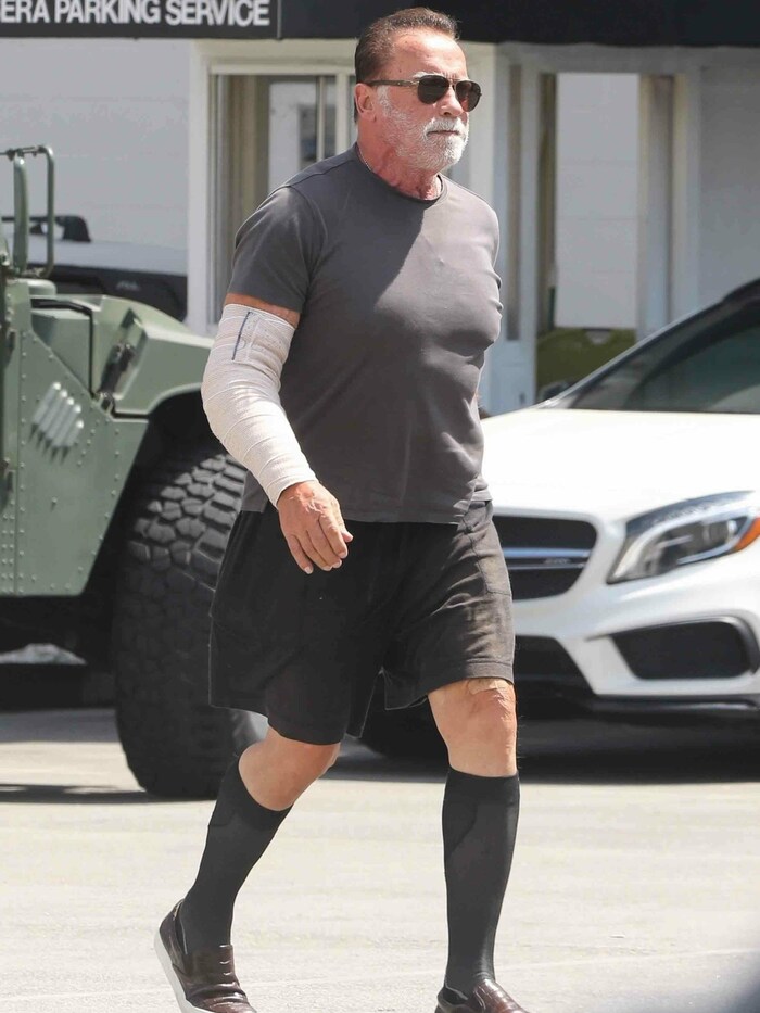 Arnold Schwarzenegger muss im Augenblick eine Arm-Bandage tragen.