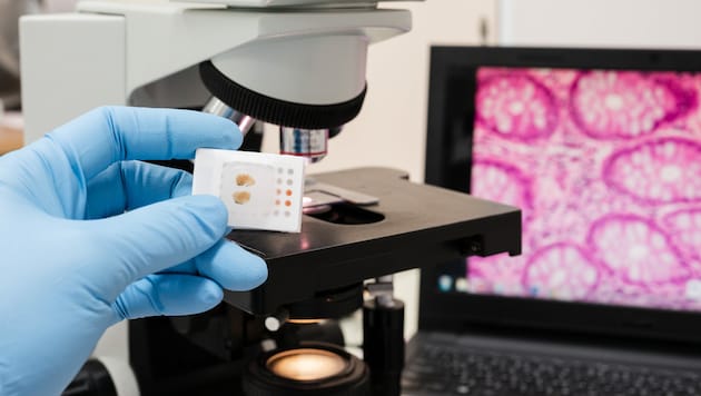 Computergestützte Diagnostik ist Teil moderner Pathologie. (Bild: arcyto/stock.adobe.com)