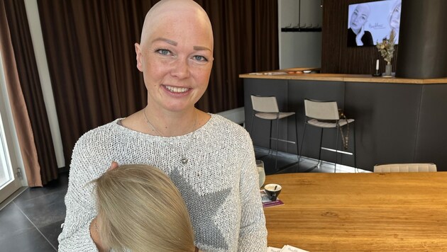 Die unter Alopezie leidende Janin Baumann nimmt Betroffenen die Angst vor der Glatze. (Bild: Katja Bieche)