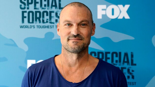 Brian Austin Green spricht über sein jahrelanges Leiden.