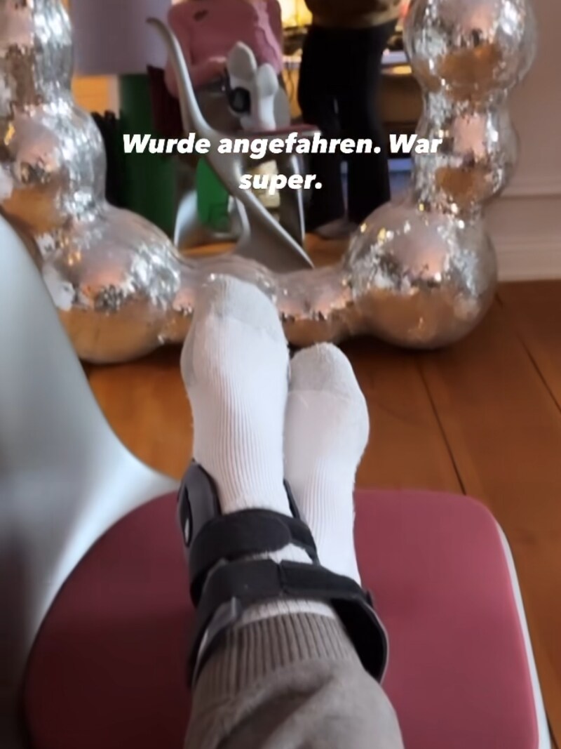 Stefanie Giesinger zeigt ihr Fußgelenk in einer Bandage. Wie es dazu gekommen ist, erklärt sie nicht. (Bild: www.instagram.com/stefaniegiesinger/)