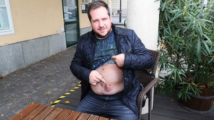 Die Wunden von S. sind noch sichtbar.