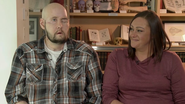 Aaron James (im Bild mit seiner Ehefrau Meagan) ist der Patient, dem ein komplettes Auge transplantiert wurde. (Bild: AP)