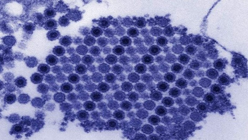 Elektronenmikroskopische Aufnahme des Chikungunya-Virus (Bild: CDC)