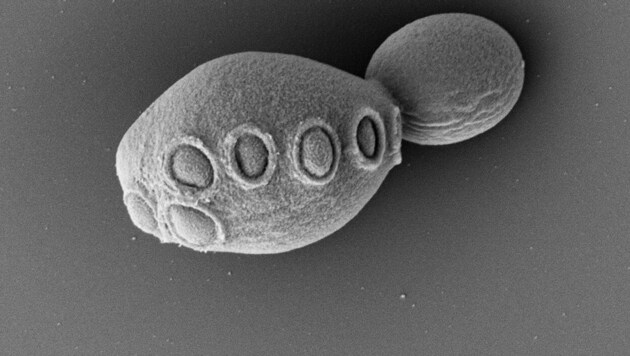 Diese knospende Hefezelle sieht völlig normal aus, die Hälfte ihres Ergbutes ist aber künstlich hergestellt worden. (Bild: © Cell/ Zhao et al.)