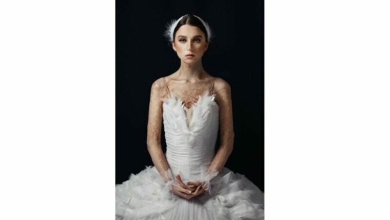 Mit dem außergewöhnlichen Porträt einer Ballerina mit Verbrennungen holte sich Alisa Matern den Bundessieg für „Natürliches Porträt“ (Bild: Alisa Matern)