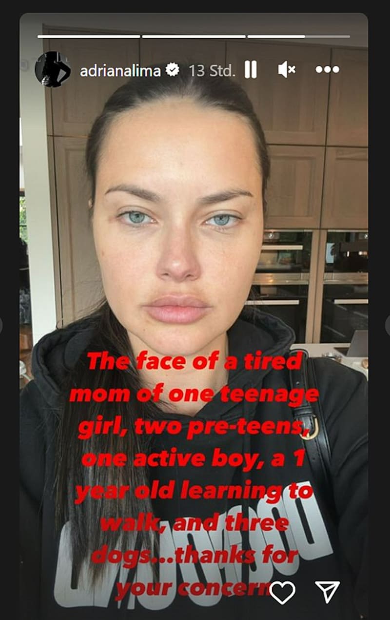 Adriana Lima setzte sich in ihrer Instagram-Story gegen böse Spekulationen, sie habe sich unters Messer gelegt, zur Wehr. (Bild: instagram.com/adrianalima)