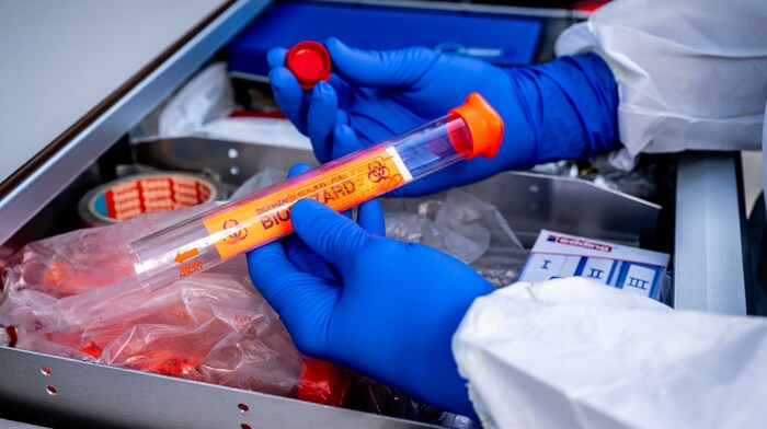 DNA-Spurem liefern eindeutige Beweise.