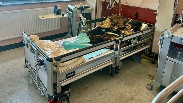 Die Matratze des Patienten fing Feuer.
