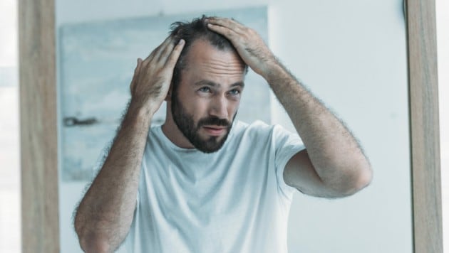 Viele Männer leiden unter Haarschwund. (Bild: LIGHTFIELD STUDIOS/stock.adobe,com)