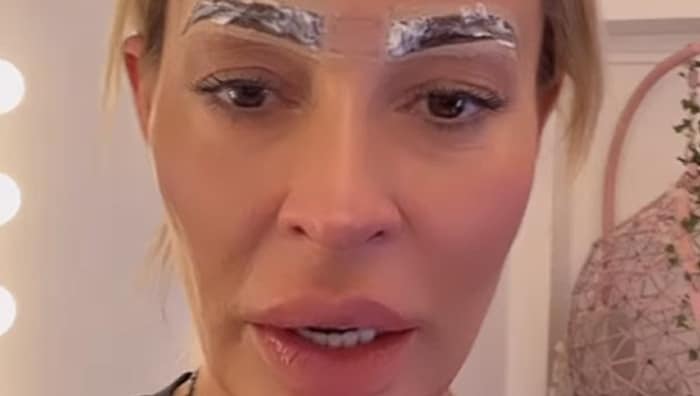 Cora Schumacher „wurde richtig hart entstellt“ und versucht nun, vor dem Dschungel-Start zu ...