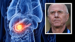 Der schwedische Fußballtrainer Sven-Göran Eriksson ist an Bauchspeicheldrüsenkrebs erkrankt. (Bild: stock.adobe.com, AP, Krone KREATIV)