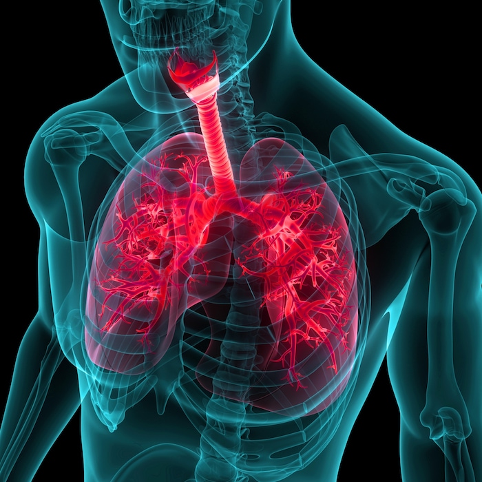 Eine Pneumonie ist eine plötzlich auftretende Erkrankung der unteren Atemwege.