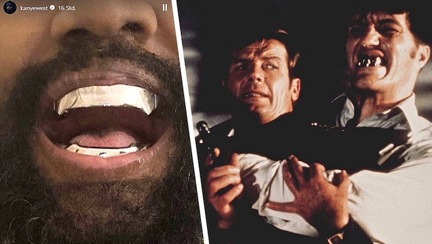Kanye West zeigt auf Instagram seine neuen 850.000-Dollar-Zähne (l.), die von Bond-Bösewicht „Beißer“ inspiriert wurden. (Bild: mptv / picturedesk.com, www.instagram.com/kanyewest, Krone KREATIV)