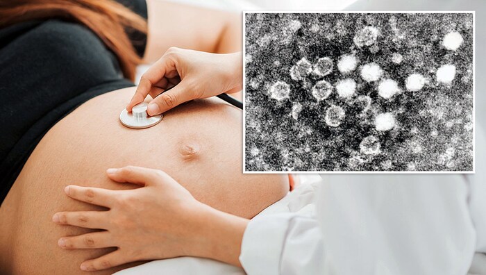 Der Parvovirus wird, wie Covid-19 oder die Grippe, über die Atemwege übertragen. 