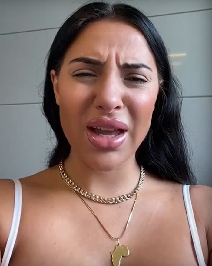 Leyla vor der Nasen-OP