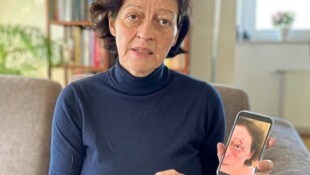 Petra M. zeigt die Verletzungen, die ihr die Kuh in Tirol zugefügt hat.