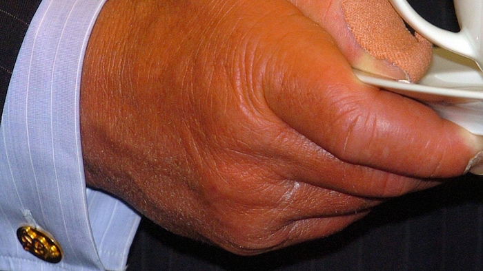 Um die Finger des Königs gab es immer wieder Spekulationen.