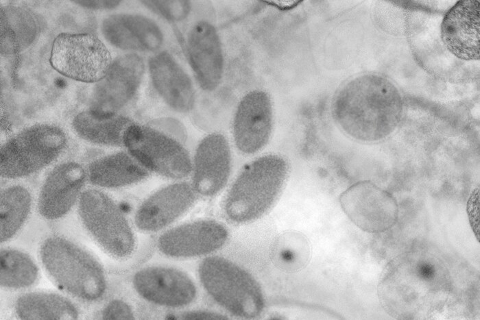 West Nile fever (pictured: images of the virus) is transmitted by mosquitoes (mosquitoes of the genus Culex).