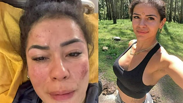 L'influenceuse Fernanda a été violée par sept hommes en Inde - sous les yeux de son partenaire ! Sur Instagram, elle a montré ses blessures. (Bild: Screenshots/Instagram.com/fernanda.4ever)