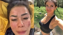 Die Influencerin Fernanda wurde in Indien von sieben Männern vergewaltigt - vor den Augen ihres Partners! Auf Instagram zeigte sie ihre Wunden. (Bild: Screenshots/Instagram.com/fernanda.4ever)