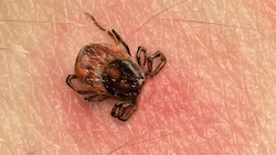 Zecken können schwere Krankheiten übertragen. (Symbolbild)