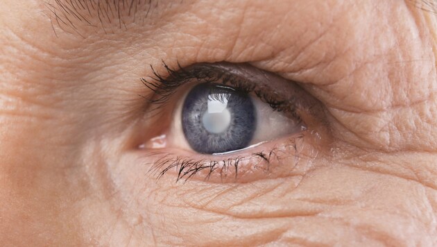 (Bild: africa-studio.com (Olga Yastremska and Leonid Yastremskiy), stock.adobe.com / KroneMED)