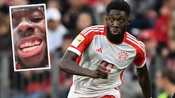 Alphonso Davies hat ein Zahn-Problem. (Bild: GEPA pictures, Instagram.com/alphonsodavies)