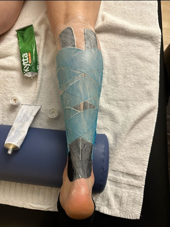 Emily Schöpf's right leg is currently too damaged to be able to take part in the battle for ...