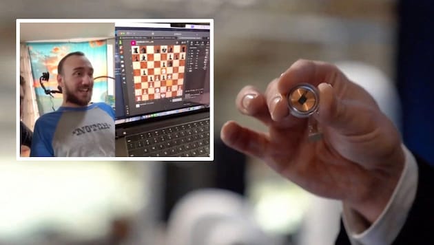 Ein implantierter Computerchip ermöglicht es dem 29-jährigen Neuralink-Patienten, mit der Kraft seiner Gedanken Schach zu spielen. (Bild: Neuralink, twitter.com/cd_doge, Krone KREATIV)