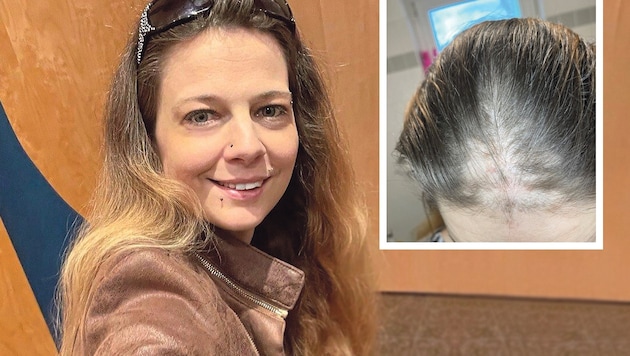 Sarah Schwaiger (40) fielen plötzlich die Haare aus – sie schildert, wie sie den Weg zurück schaffte. (Bild: Krone KREATIV, zVg)
