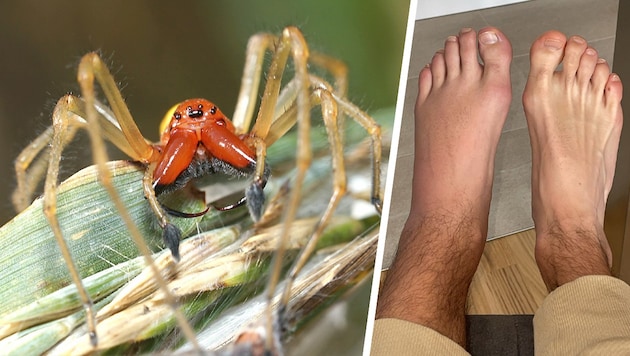 The symptoms of a bite from the nurse thorn finger are similar to those of a wasp sting. (Bild: Krone KREATIV, Michael Titz, zVg.)