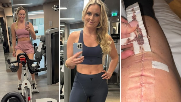 Lindsey Vonn trains - and shows the scar after her knee operation. (Bild: Instagram.com/lindseyvonn)