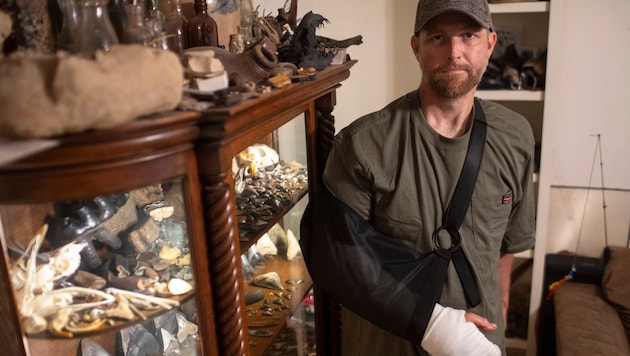 Will Georgitis timsah saldırısından sonra bandajlı koluyla (Bild: ASSOCIATED PRESS)