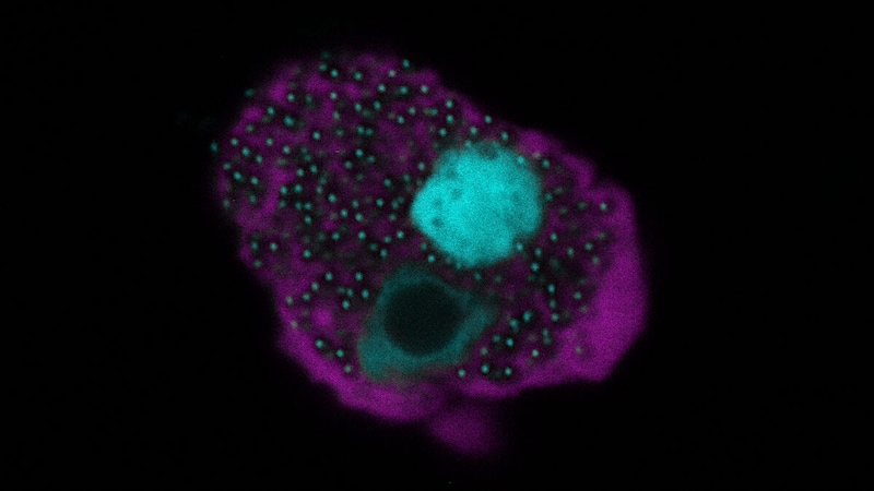 Eine mit dem Naegleriavirus infizierte Amöbenzelle. In der fluoreszenzmikroskopischen Aufnahme ist die sogenannte Virusfabrik sowie dort frisch produzierter Viren (in hellblau) innerhalb der Amöbenzelle (lila) zu erkennen. (Bild: Patrick Arthofer und Florian Panhölzl)