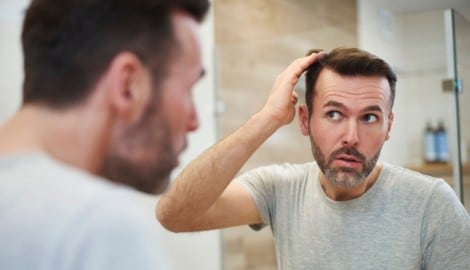 Es gibt viele verschiedene Ursachen für Haarverlust. (Bild: stock.adobe.com/Gpoint Studio)