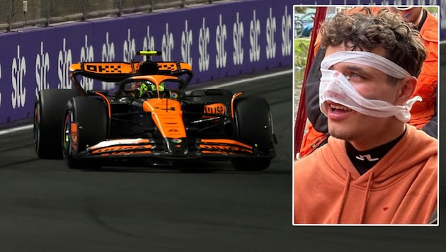 Lando Norris hat sich eine Schnittwunde im Gesicht zugezogen. (Bild: APA/AFP/JOSEPH EID, twitter.com)